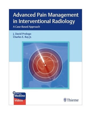 Advanced Pain Management in Interventional Radiology