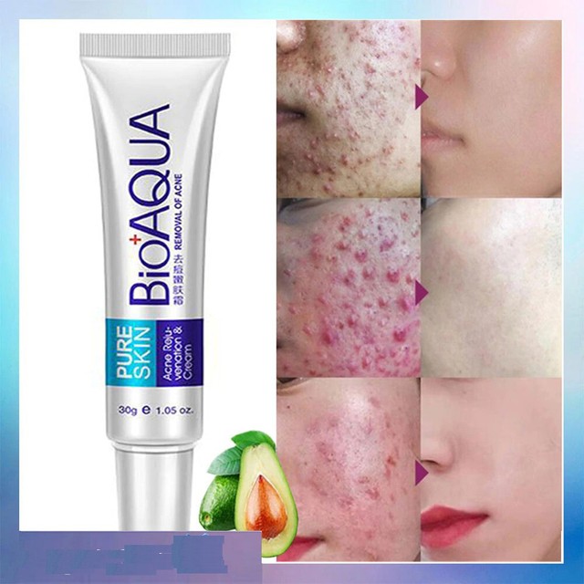 bioaqua acne series