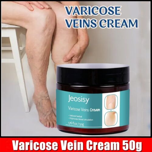 Varicose Vein Cream for Legs - Varicose Veins Cream