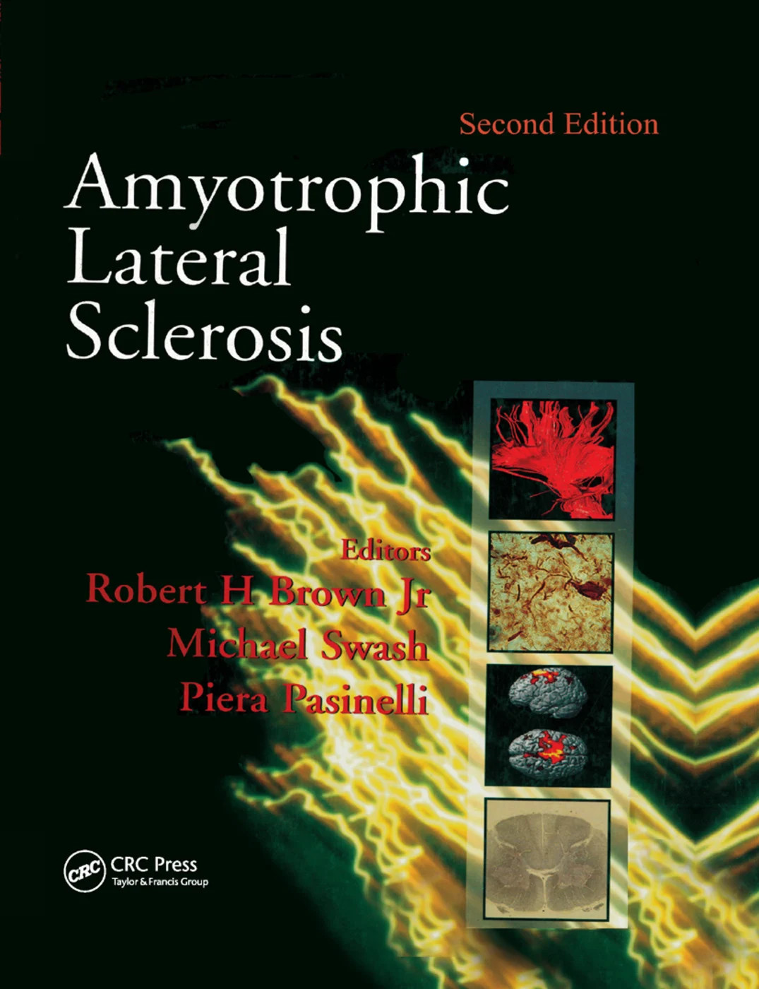 Amyotrophic Lateral Sclerosis, Second Edition - 2nd Edition