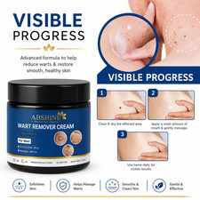 Genital Wart Removal Treatment Cream free packaging included 50 Gram 1.76 oz