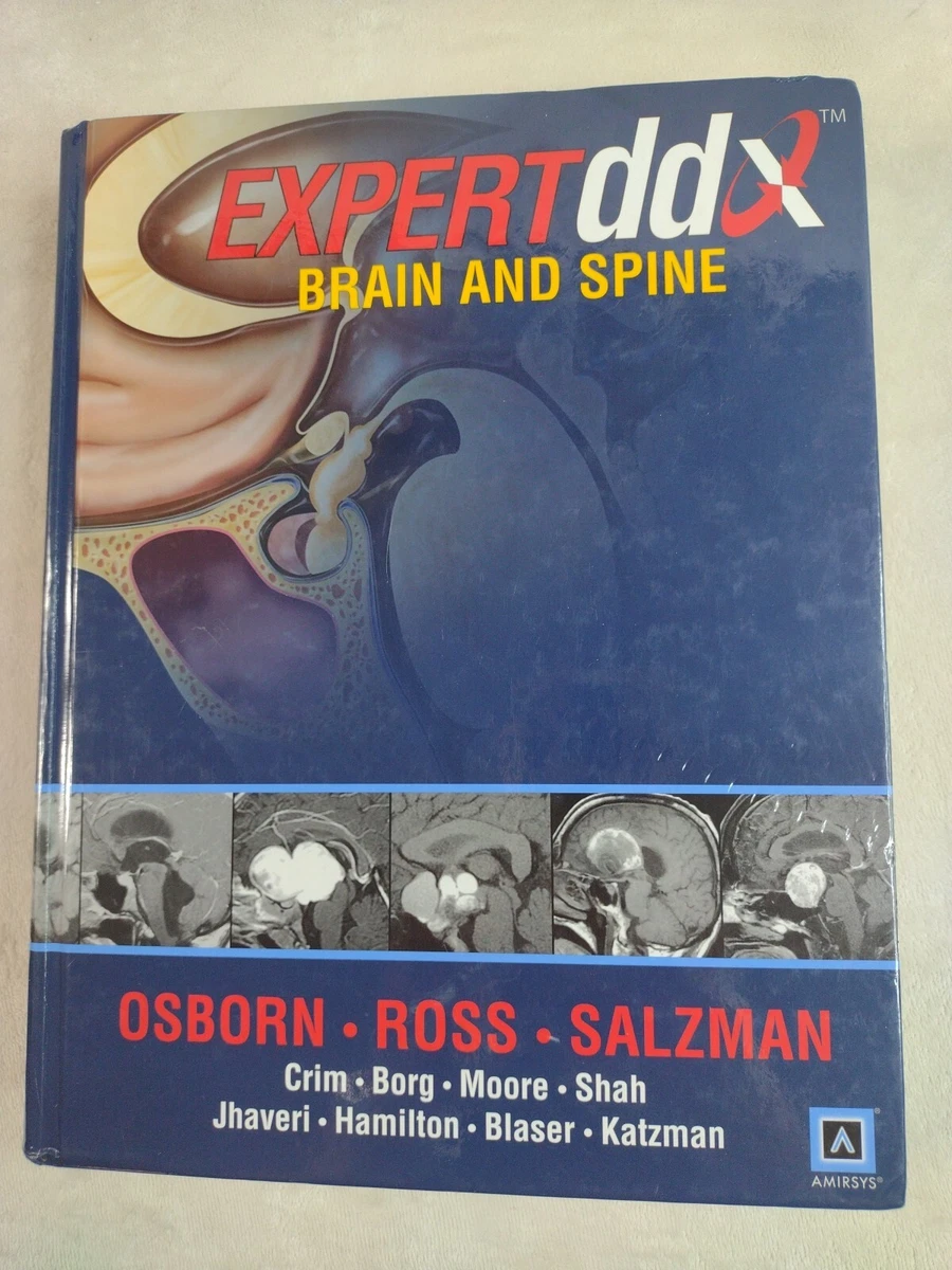 洋書 Expert ddx brain and spine Amazon | EXPERTddx™: Brain and Spine (Expert Differential