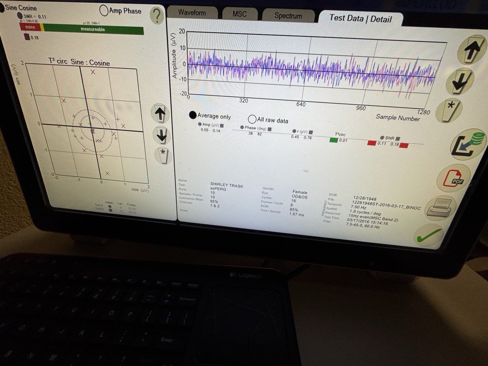 Konan Evoke DX VEP/ERG