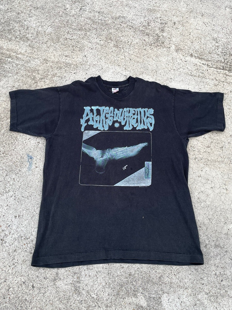 Vintage Original 1992 Alice In Chains Broken Foot X-Ray Concert