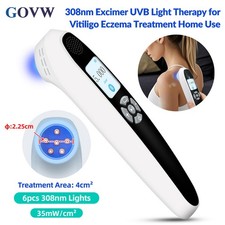 308nm UV Light Facial Feet Skin Diseases Care Phototherapy Treatment 35mW/cm 
