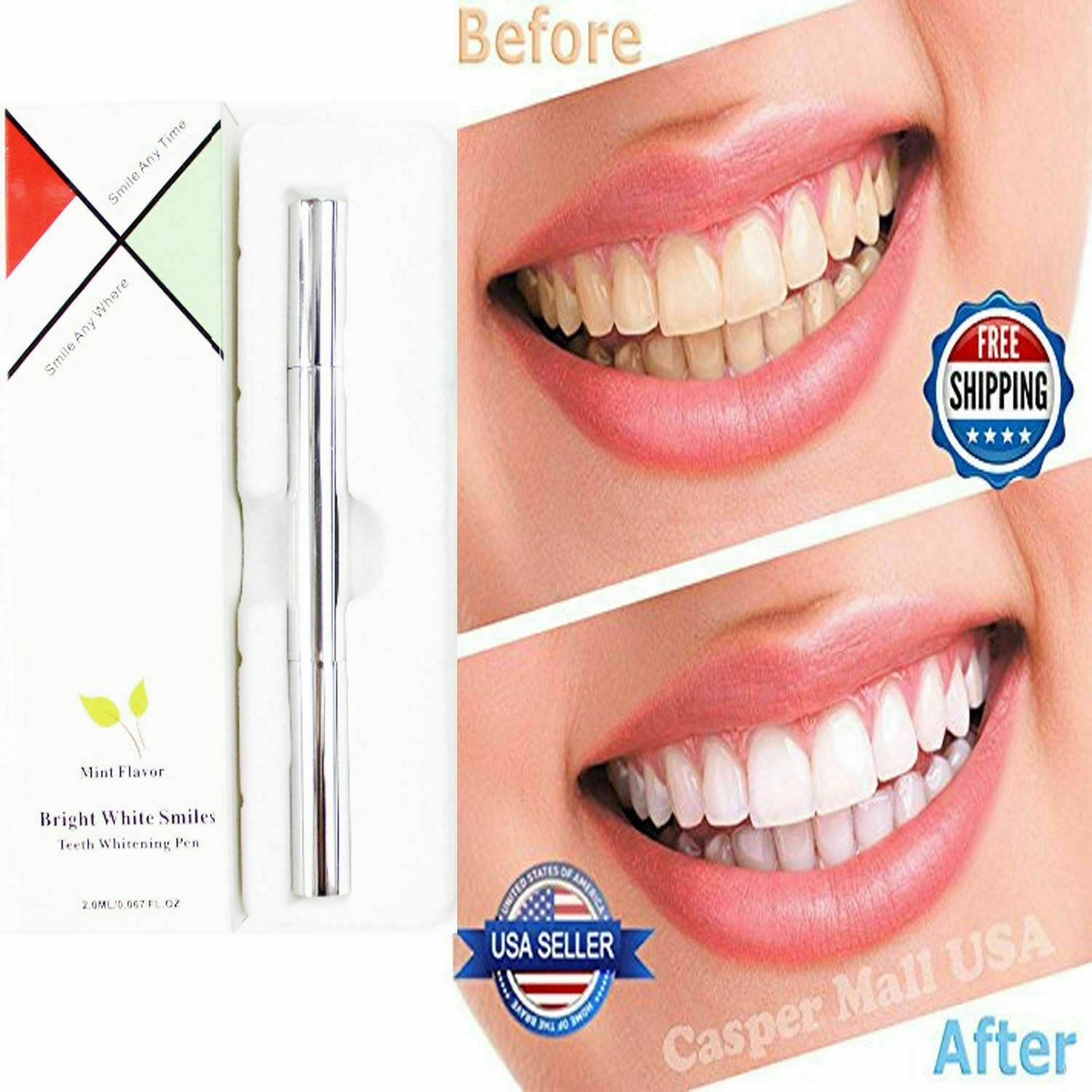 White Teeth Viebeauti Teeth Whitening Pen Reviews Sensitive Teeth