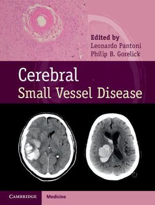 Cerebral Small Vessel Disease, Hardcover by Pantoni, Leonardo, M.D., Ph.D. (E...