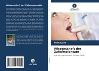 Reeta Jain | Wissenschaft Der Zahnimplantate | Taschenbuch | Deutsch (2021)