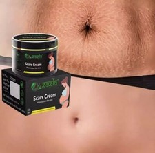 Best Scar Removal-Cream for Old-Scars Stretch Mark Removal Cream UNISEX 100gm