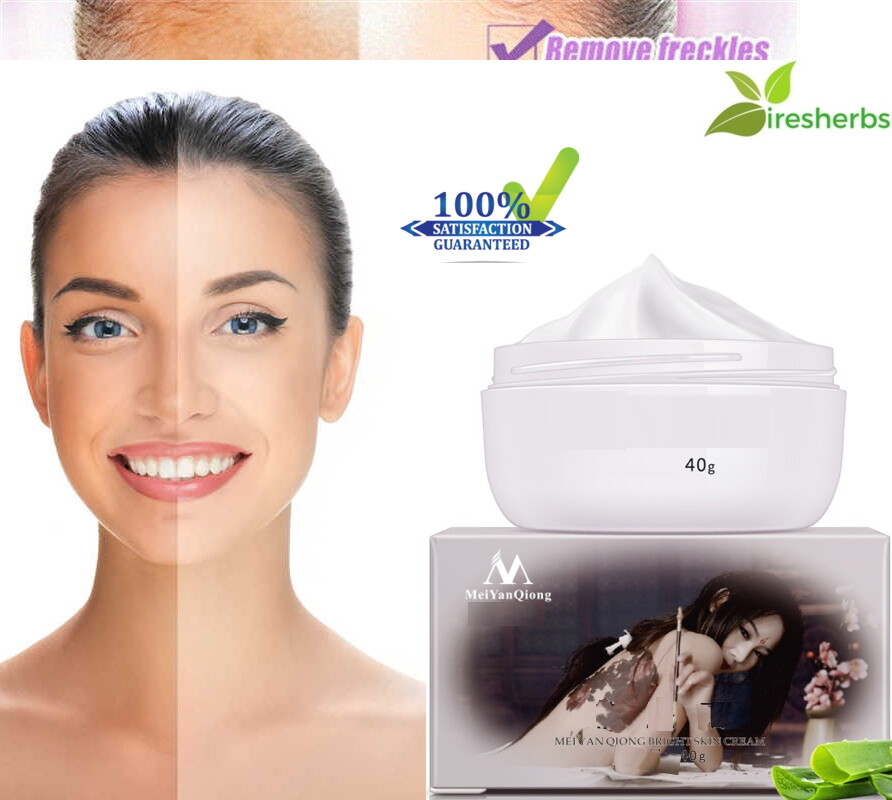 best acne pigmentation cream