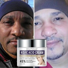 Kojic Acid Skin Brightening Cream for Face and Body with Glycolic Acid - 2oz