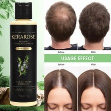 Kerarose Organic Rosemary Shampoo for Thinning Hair & Hair Loss Hair Growth