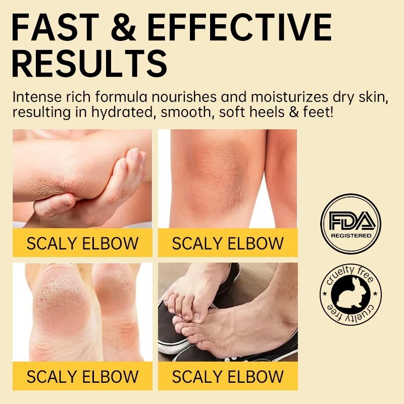 Crema para pies Aavini 50 g - Repara tacones agrietados | Hidratante y antibacteriana - Foto 13 de 16