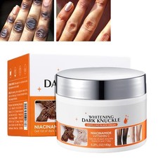 New Strong Whitening Cream For Removing Dark Knuckle Finger Elbow and Knee USA