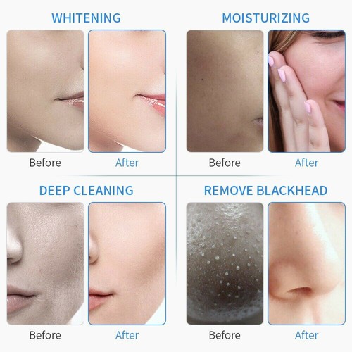 6/7 in 1 Hydra Water Facial Cleaner Aqua Peel Hydro Dermabrasion Beauty Machine - Picture 8 of 71