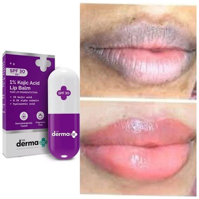 The Derma Co 1% Kojic Acid Lip Balm For Dark & Pigmented Lips - 4G Off White 