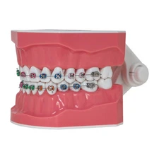 US Dental Orthodontic Typodont 1:1 Teeth Model M7010-2 with Brackets Braces