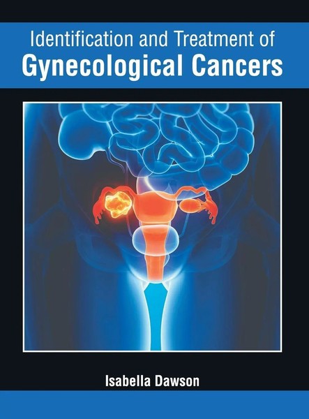Isabella Dawson | Identification And Treatment Of Gynecological Cancers | Buch-image