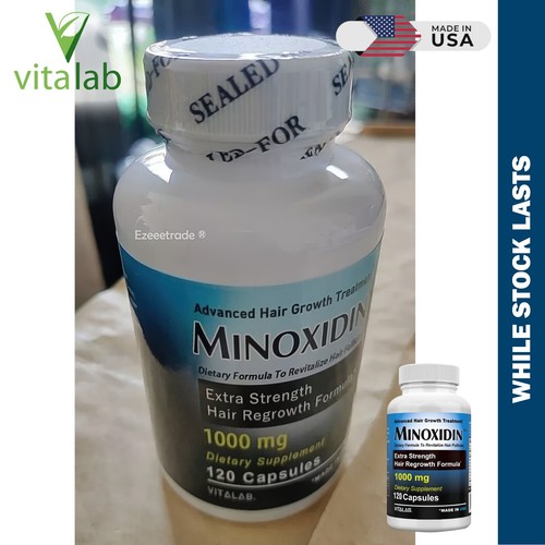 MINOXIDINA 1000mg Crecimiento del Cabello 120 Comprimidos Extra Fuerza Hombres Mujeres Recrecimiento EE. UU. - Imagen 10 de 21