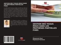 Gestion DES Tissus Mous Dans LES ProthÈSes Partielles Fixes Kaur (U. A.) Buch