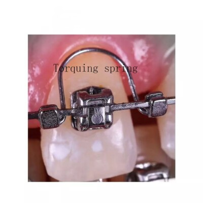 Fil D'arche à Ressort Orthodontique - Couple Torquing Pour Dents Antérieures - Neuf
