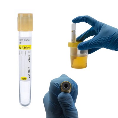 LabXcel Urine Specimen Containers 100mL with Screw Cap & Transfer Device
