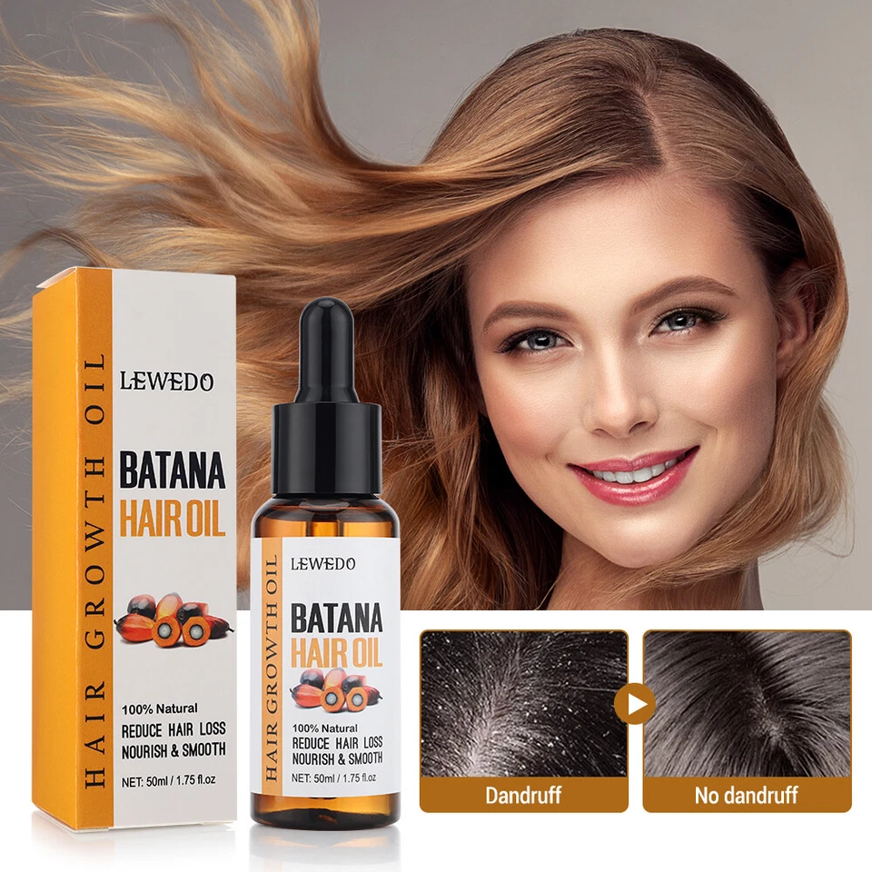 1-5* Batana Oil Organic for Hair Growth, Botana Oil Hair Growth Anti Hair Loss - Image 3 of 4