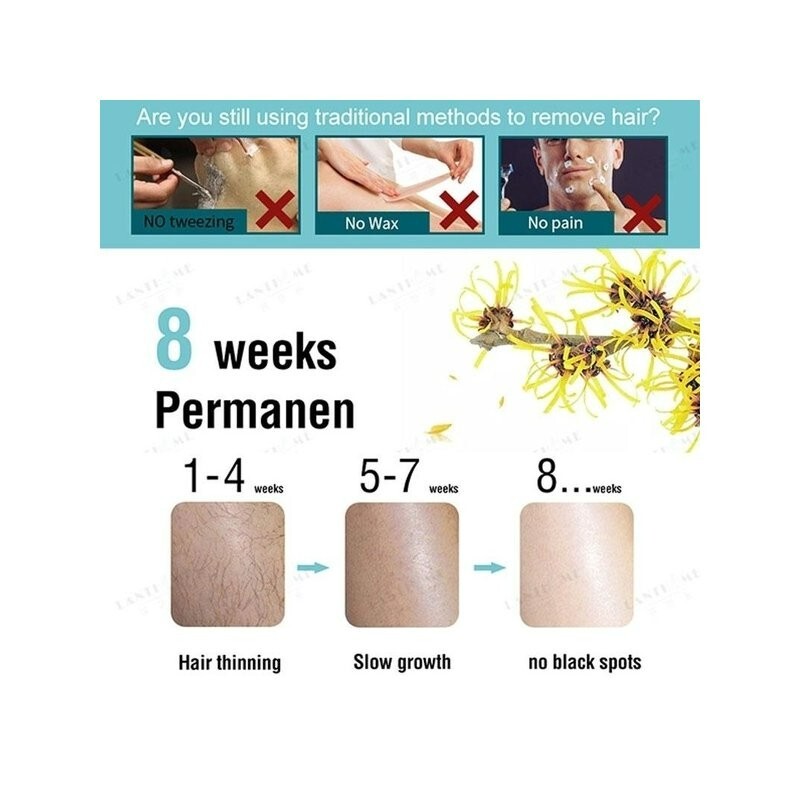 Update 160+ natural hair removal dedaotaonec