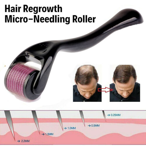 Hair Regrowth Micro-Needling Roller Stimulates Hair Growth 540 Titanium Painless - Picture 1 of 12