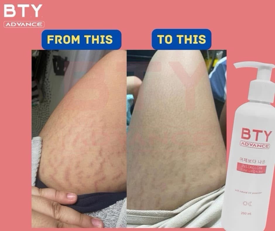 ボディローション Bty Advance Instaglow Tone up cream BTY INSTAGLOW FACE AND BODY TONE UP ORIGINAL (FDA APPROVED