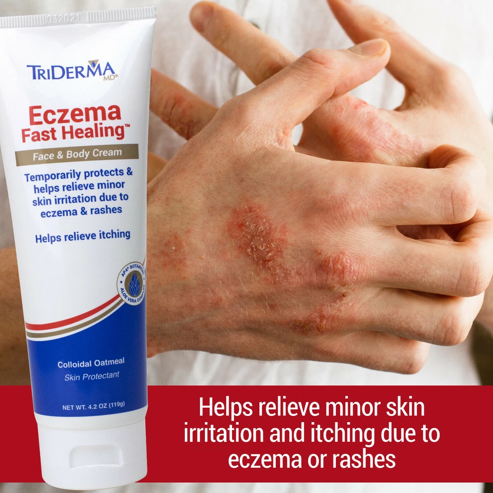 TriDerma Eczema Fast Healing Face & Body Soothing Cream - FSA Eligible - 4.2 oz - Image 2 of 4