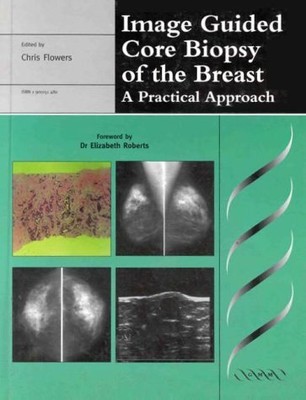IMAGE GUIDED CORE BIOPSY OF THE BREAST: A PRACTICAL By Chris Flowers - Hardcover