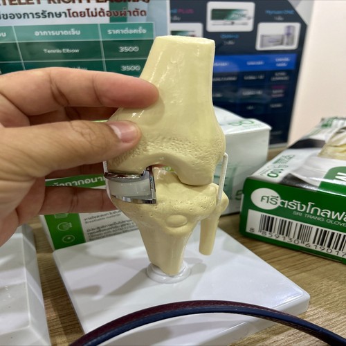 Detachable Artificial knee prosthesis Medical Anatomical Teaching Display model - Picture 29 of 29