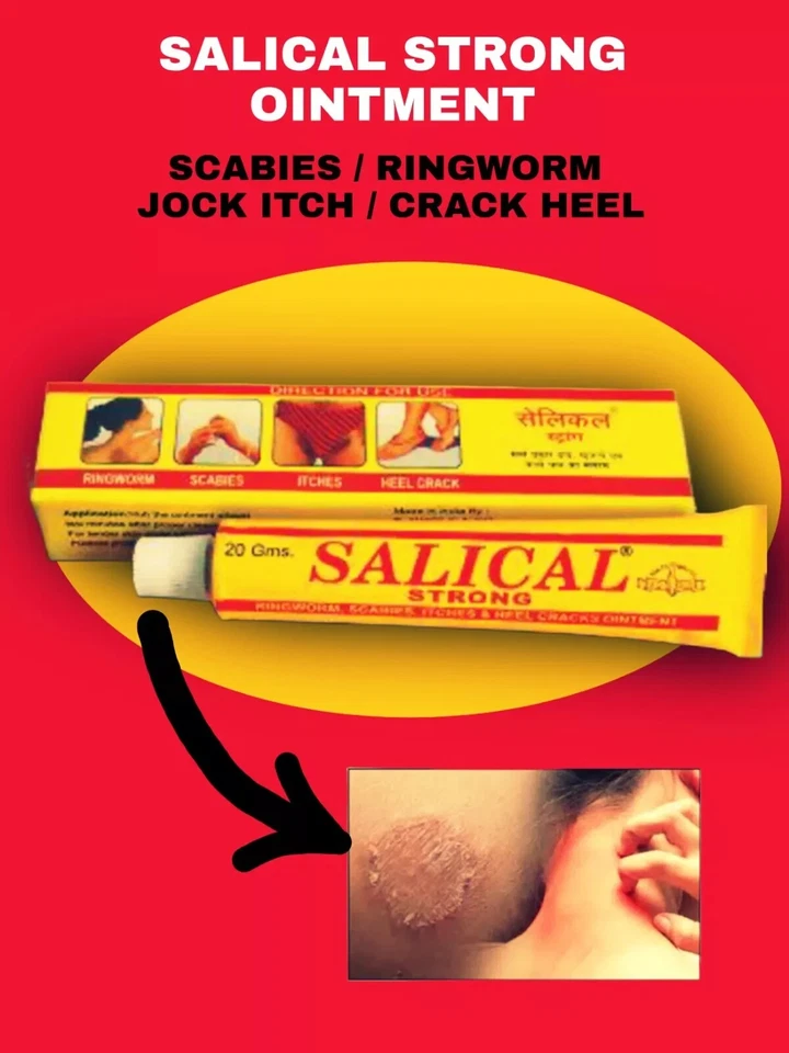 SEIFE & SALBE COMBO KIT FÜR KRÄTZE MILBEN & EIER KOMPLETTE AUSROTTUNG KOSTENL... - Bild 3 von 4