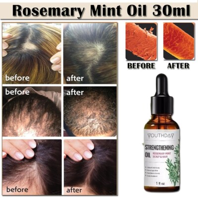 Organics Rosemary Mint Scalp & Hair Strengthening Oil w/ Biotin 1oz