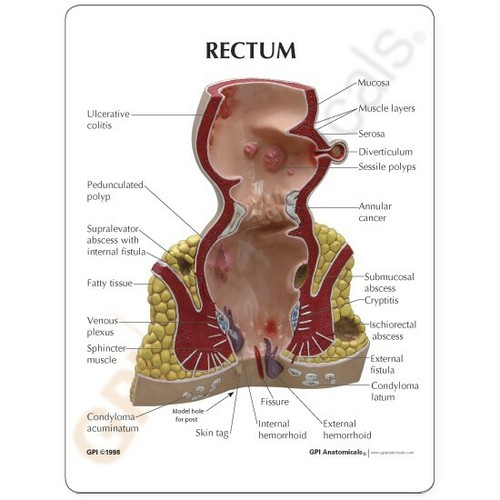 Rectum Anatomical Model GPI LFA #3350 SEE VIDEO Make Us an Offer! - Picture 3 of 3