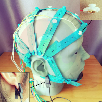 eeg 2011年 Frontiers | Epileptic seizure clustering and accumulation at