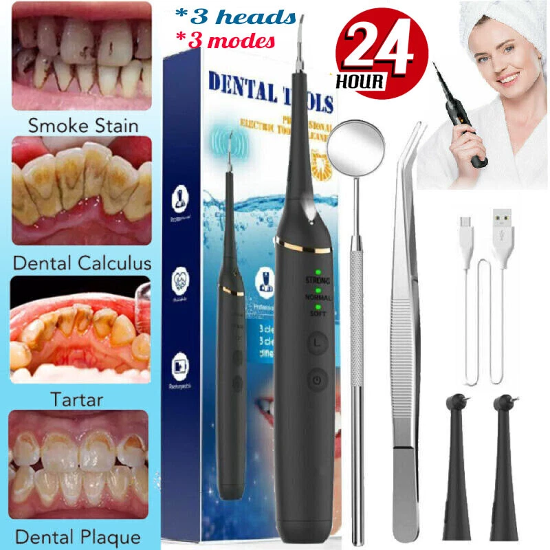 Calculus removal deals