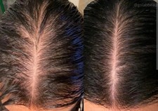 RAPID GROWTH HERBAL HAIR  OIL FAST RESULTS
