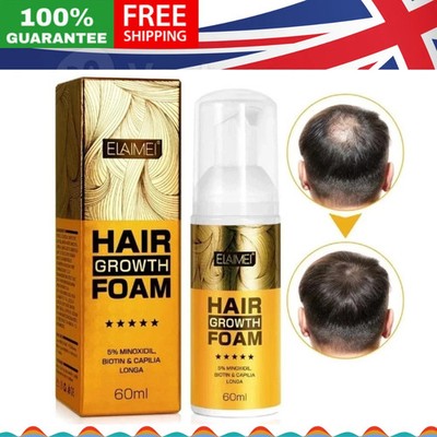 5% Minoxidil Haar Nachwachsen Schaum Behandlung für Männer Haarwachstum Anti Haarausfall