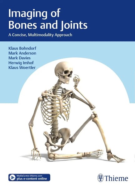 Imaging Of Bones And Joints | A Concise, Multimodality Approach | Englisch-image