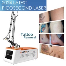 Picosecond Laser Nd Yag Color Tattoo Removal Deep Skin Rejuvenation Pico Machine