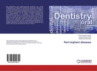 Fabricio Batistin Zanatta (U. A.) | Peri-Implant Diseases | Taschenbuch (2016)