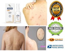 2 Salicylic Acid Salyzap Body Acne Spray 50ml for Acne on Body