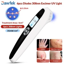 Narrowband 308nm UVB Phototherapy Lamp Home Use for Eczema Dermatitis 35mW/cm²