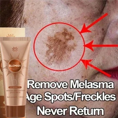 AIGEYOUPING Face Whitening Mask Blemish Spot Removing, Herbal Spots Peel-Off Facial Mask UK