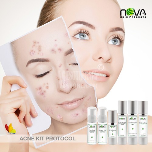 Kit de 6 productos para acné de Nova Skin - Imagen 3 de 6