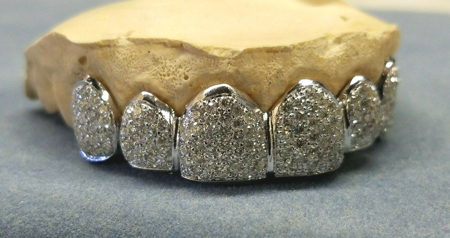 14K Solid Yellow or White Gold 6pc Top REAL Diamond GRILLZ Gold Teeth