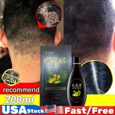 2025 Scalp Hair Follicle Shampoo Antibacterial Anti-Itching Mites Oil Control US