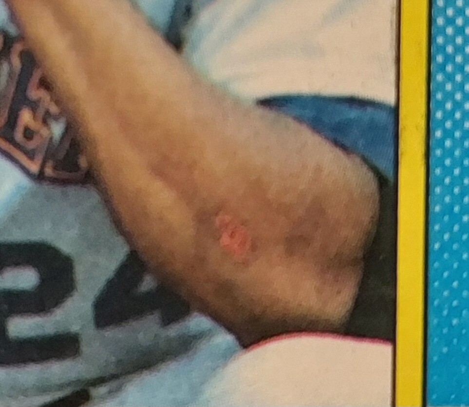 Ken Griffey Jr: The Bloody Scab Error Card | eBay